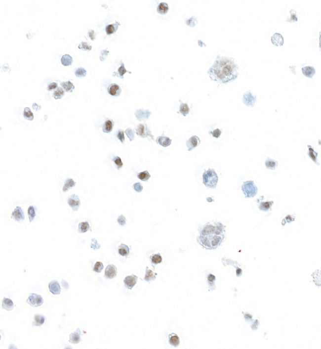 STAT5b Antibody in Immunocytochemistry (ICC/IF)