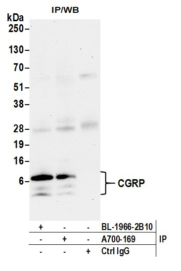CGRP Antibody in Immunoprecipitation (IP)