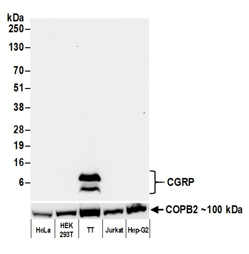 CGRP Antibody in Western Blot (WB)