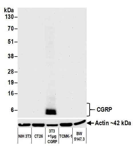 CGRP Antibody in Western Blot (WB)