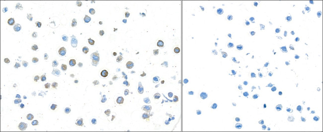 TGF-beta 1 Antibody in Immunocytochemistry (ICC/IF)