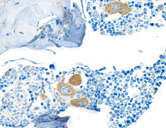 TGF-beta 1 Antibody in Immunohistochemistry (Paraffin) (IHC (P))