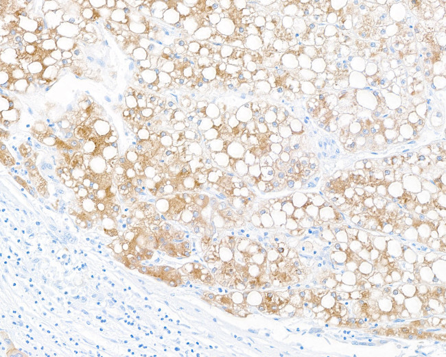 Hepassocin/FGL1 Antibody in Immunohistochemistry (Paraffin) (IHC (P))