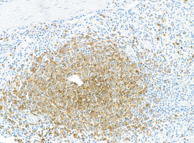 CD79B Antibody in Immunohistochemistry (Paraffin) (IHC (P))