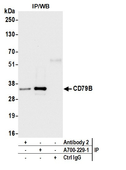 CD79B Antibody in Immunoprecipitation (IP)
