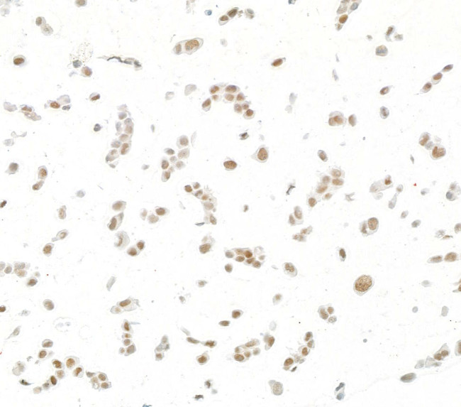 JDP2 Antibody in Immunocytochemistry (ICC/IF)