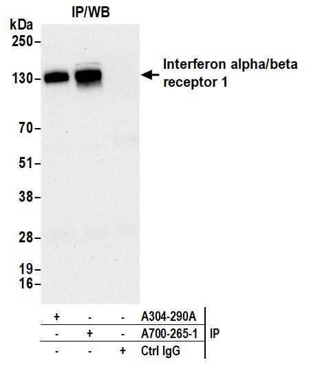 Interferon alpha/beta receptor 1 Antibody in Immunoprecipitation (IP)