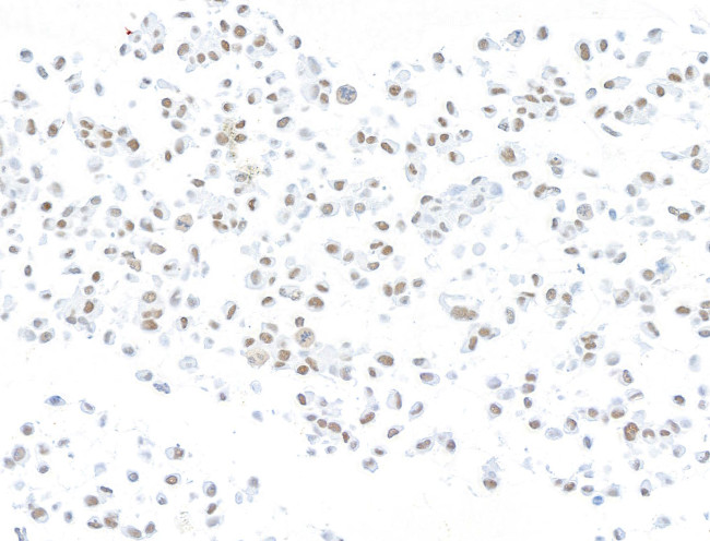 ARID1A/BAF250 Antibody in Immunocytochemistry (ICC/IF)