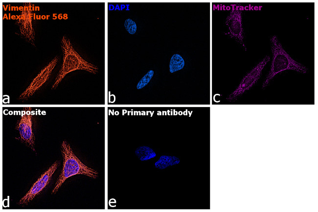 Double immunofluorescence staining for TET2 (Alexafluor 568: red) and