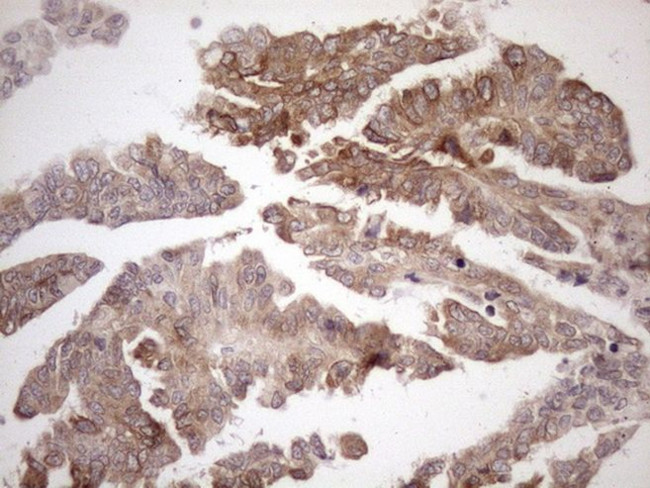 AAAS Antibody in Immunohistochemistry (Paraffin) (IHC (P))