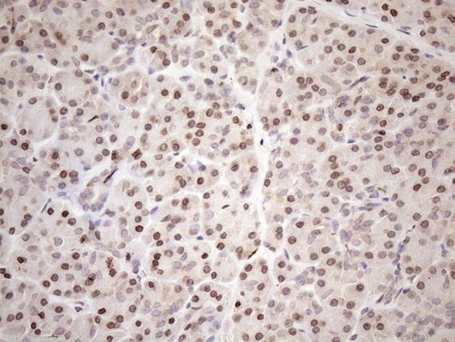 AAAS Antibody in Immunohistochemistry (Paraffin) (IHC (P))