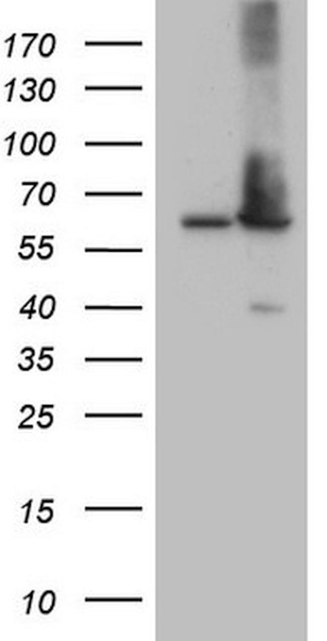 AAAS Antibody in Western Blot (WB)