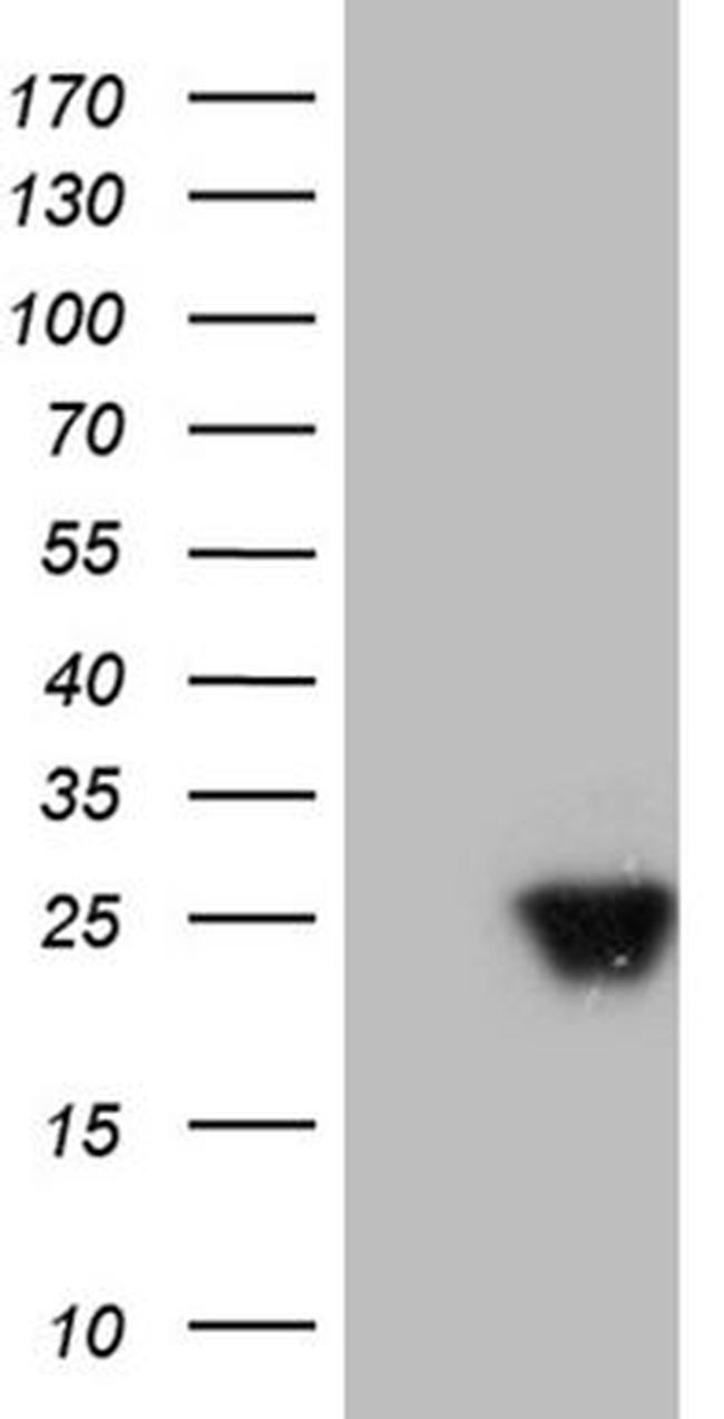 AANAT Antibody in Western Blot (WB)