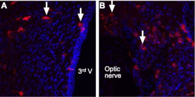 Angiotensin II Receptor Type-2 (extracellular) Antibody in Immunohistochemistry (IHC)