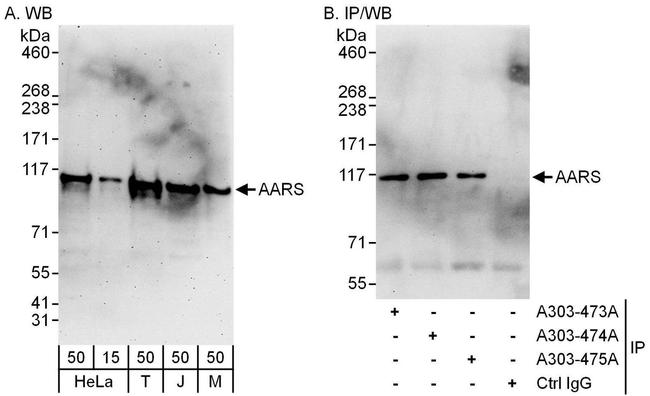 AARS Antibody in Western Blot (WB)