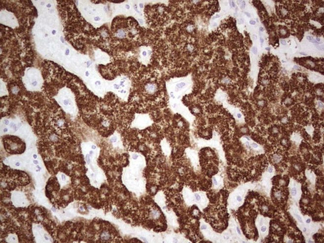 ABAT Antibody in Immunohistochemistry (Paraffin) (IHC (P))