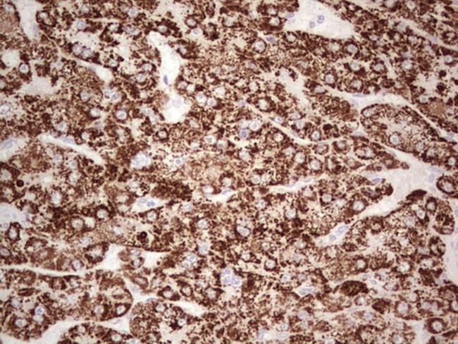 ABAT Antibody in Immunohistochemistry (Paraffin) (IHC (P))