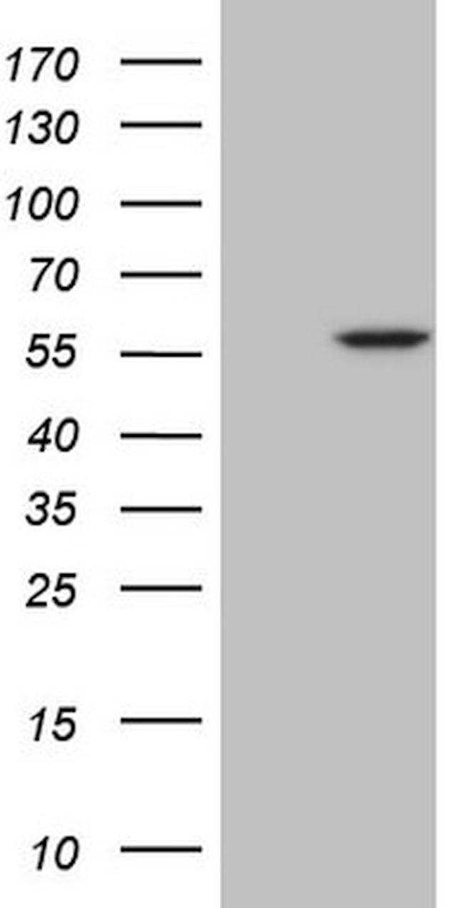 ABAT Antibody in Western Blot (WB)