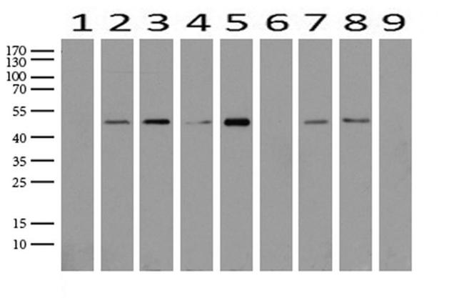 ABAT Antibody in Western Blot (WB)