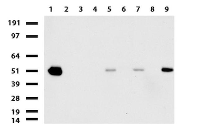 ABAT Antibody in Western Blot (WB)