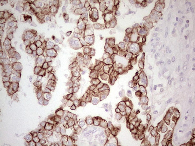 ABCB1 Antibody in Immunohistochemistry (Paraffin) (IHC (P))