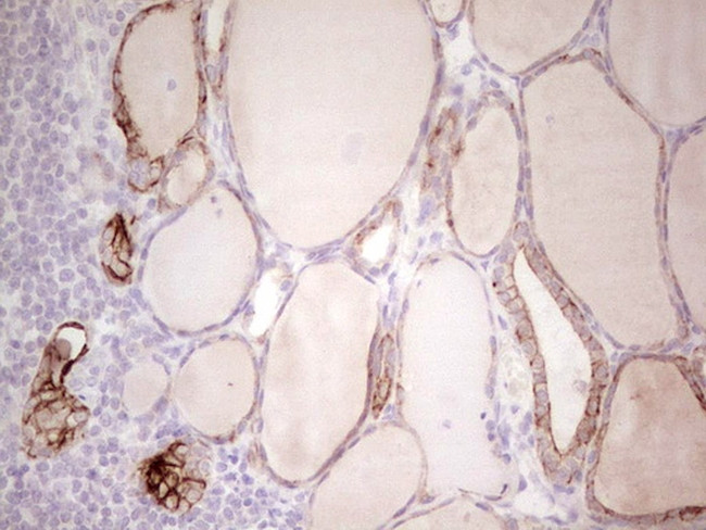 ABCB1 Antibody in Immunohistochemistry (Paraffin) (IHC (P))