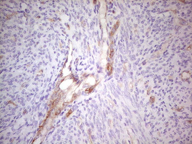 ABCB1 Antibody in Immunohistochemistry (Paraffin) (IHC (P))