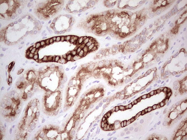 ABCB1 Antibody in Immunohistochemistry (Paraffin) (IHC (P))