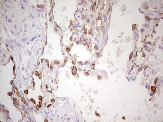 ABCB1 Antibody in Immunohistochemistry (Paraffin) (IHC (P))