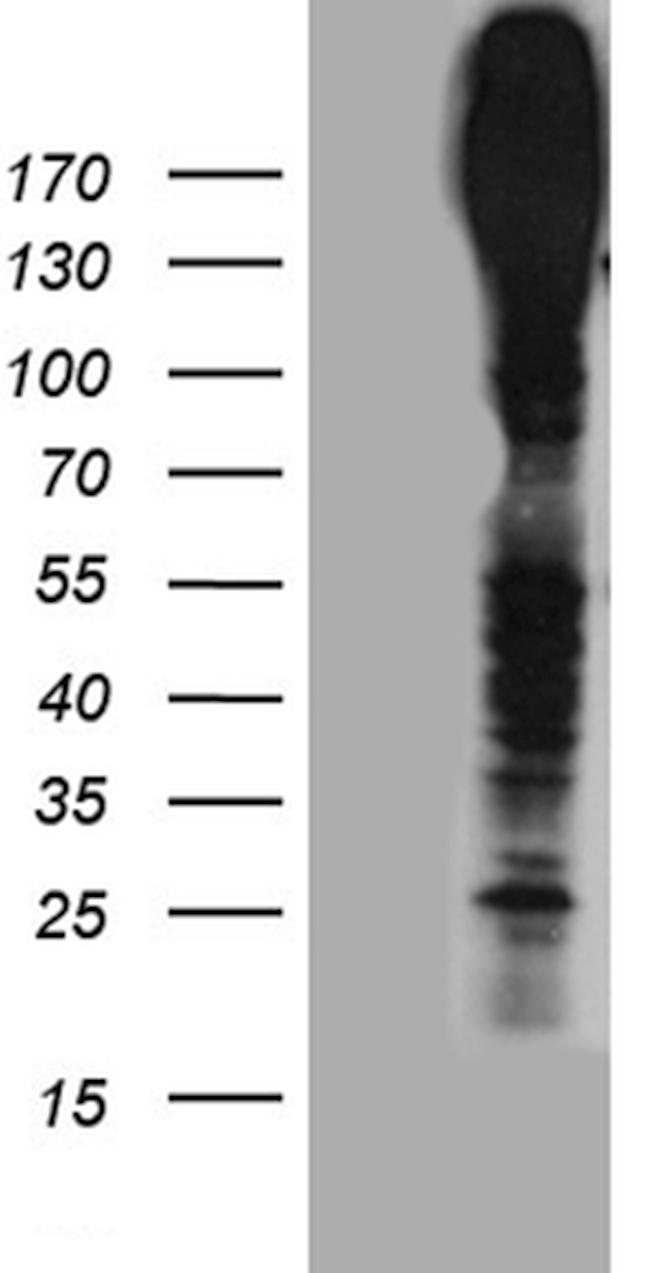 ABCC3 Antibody in Western Blot (WB)