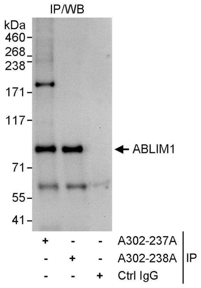 ABLIM1 Antibody in Immunoprecipitation (IP)