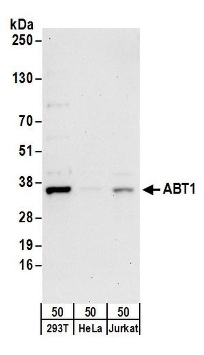 ABT1 Antibody in Western Blot (WB)