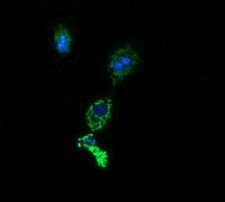 ACAA2 Antibody in Immunocytochemistry (ICC/IF)