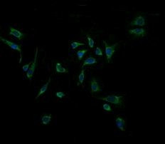 ACAA2 Antibody in Immunocytochemistry (ICC/IF)