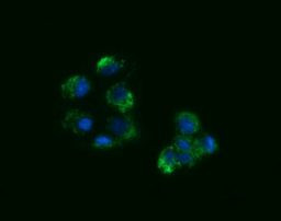 ACAA2 Antibody in Immunocytochemistry (ICC/IF)