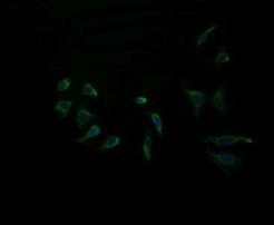 ACAA2 Antibody in Immunocytochemistry (ICC/IF)