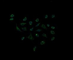 ACAA2 Antibody in Immunocytochemistry (ICC/IF)