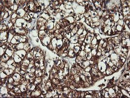 ACAA2 Antibody in Immunohistochemistry (Paraffin) (IHC (P))