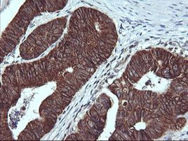 ACAA2 Antibody in Immunohistochemistry (Paraffin) (IHC (P))