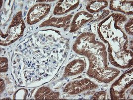 ACAA2 Antibody in Immunohistochemistry (Paraffin) (IHC (P))