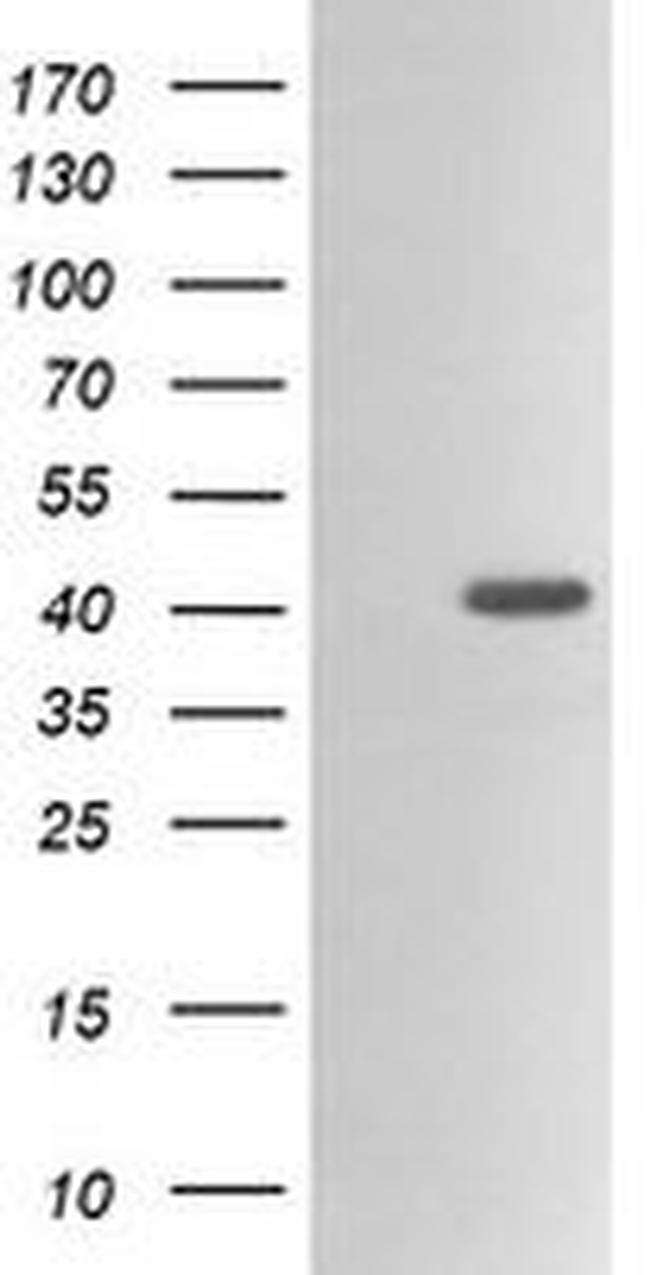 ACAA2 Antibody in Western Blot (WB)