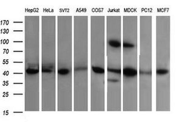 ACAA2 Antibody in Western Blot (WB)