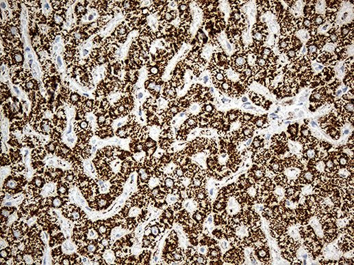 ACADM Antibody in Immunohistochemistry (Paraffin) (IHC (P))