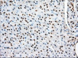 ACAT2 Antibody in Immunohistochemistry (Paraffin) (IHC (P))