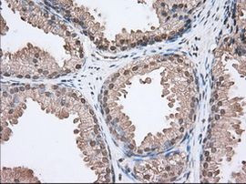 ACAT2 Antibody in Immunohistochemistry (Paraffin) (IHC (P))