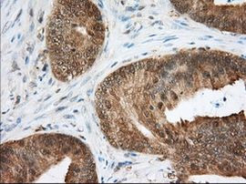 ACAT2 Antibody in Immunohistochemistry (Paraffin) (IHC (P))