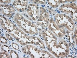 ACAT2 Antibody in Immunohistochemistry (Paraffin) (IHC (P))