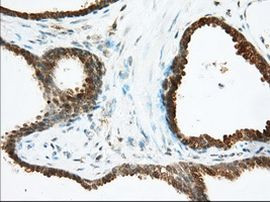 ACAT2 Antibody in Immunohistochemistry (Paraffin) (IHC (P))