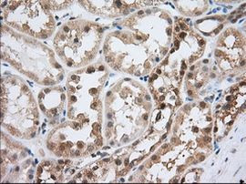 ACAT2 Antibody in Immunohistochemistry (Paraffin) (IHC (P))