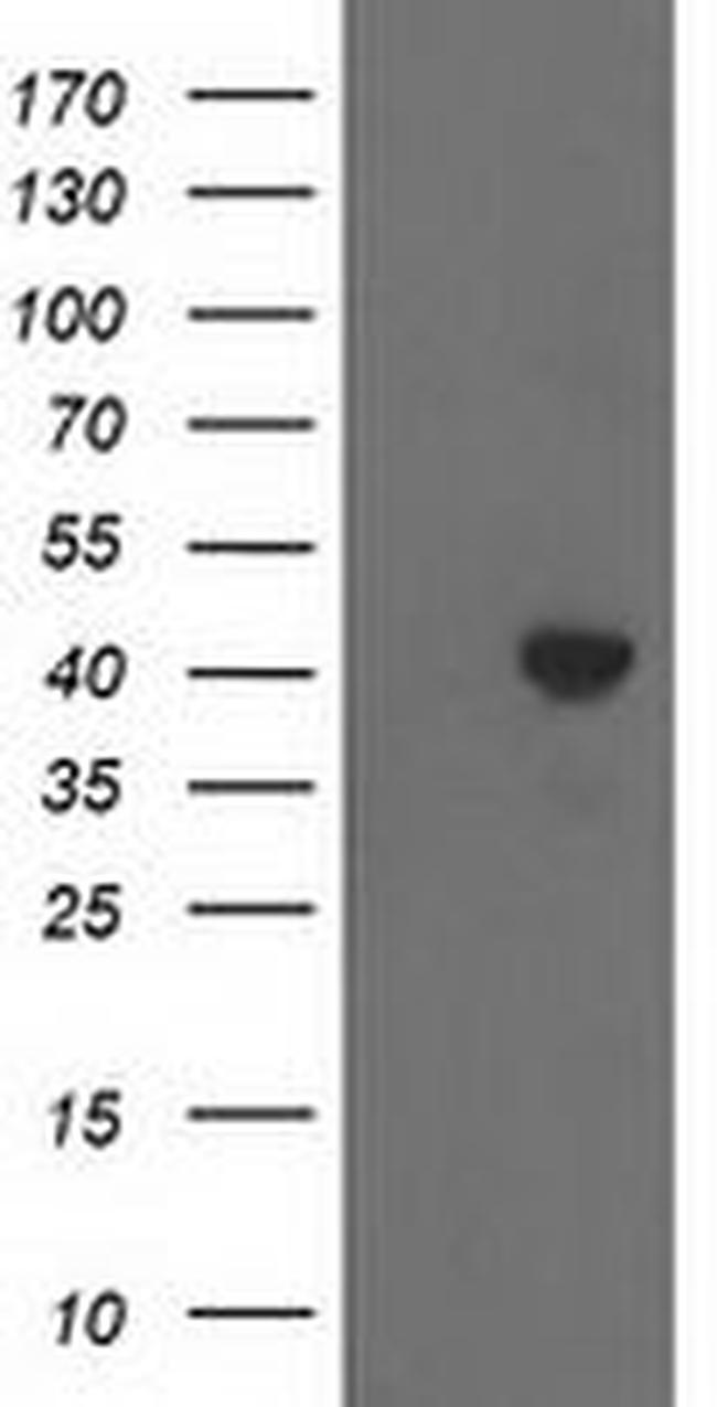 ACAT2 Antibody in Western Blot (WB)